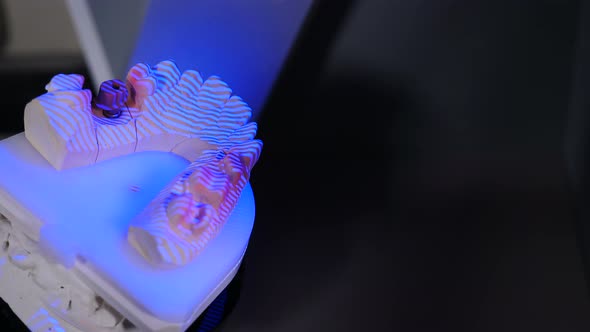 Dental Reconstruction of Jaw with 3D Dental Scanner. Modern Dental Clinic Laboratory. Hi-tech Dental
