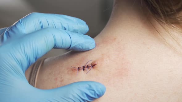 Examination of the Sutured Wound Closeup