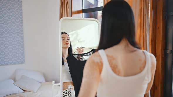 Young Lady with Vitiligo Spots Choosing Dress Looking at Mirror at Home Slow Motion