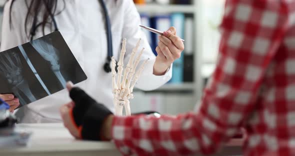 Doctor with x Ray Showing Patient with Broken Arm Artificial Hand Model Closeup  Movie