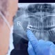 Dentist Close Up On X Ray - VideoHive Item for Sale