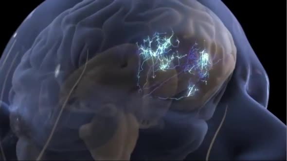 3D Animation of Neural Brain Activity Rotating on Black Background