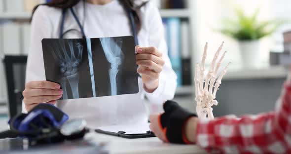 Doctor Traumatologist Looking Xray of Patient Hand in Clinic  Movie