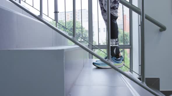 Woman with prosthetic leg at hospital