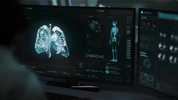 Doctor has found the deadly lung cancer in a patient using the scanner equipment alt