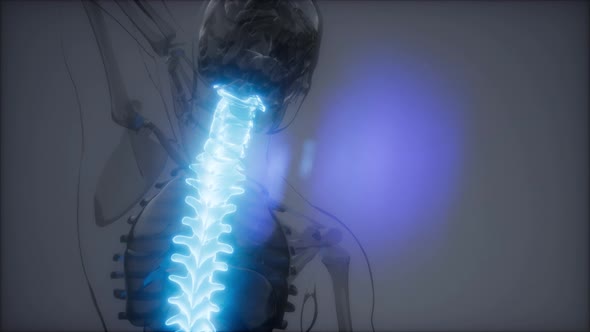 Backache in Back Bones alt