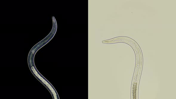 A Nematode Worm Under a Microscope, There Are Free-living, Commensals and Parasites