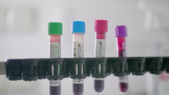 Test Tubes With Material for Laboratory Testing or Experiments. Medical Equipment for Research.