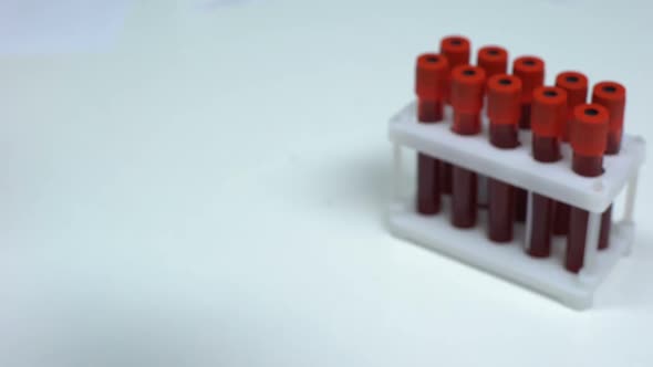 Negative Adenovirus, Doctor Showing Blood Sample, Lab Research, Healthcare