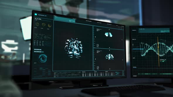 Multiple Windows Show Digital Model Of Brain For Cancer Examination At Hospital. alt