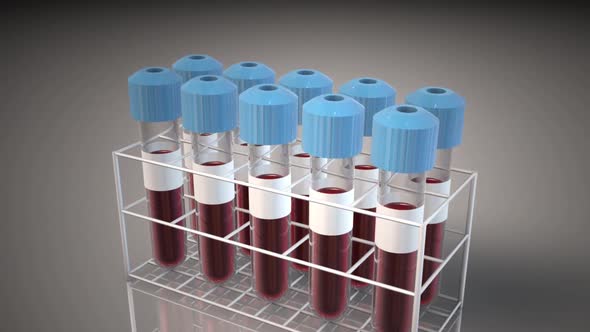 Provides an introduction to commonly used blood vials and research that can each be used.