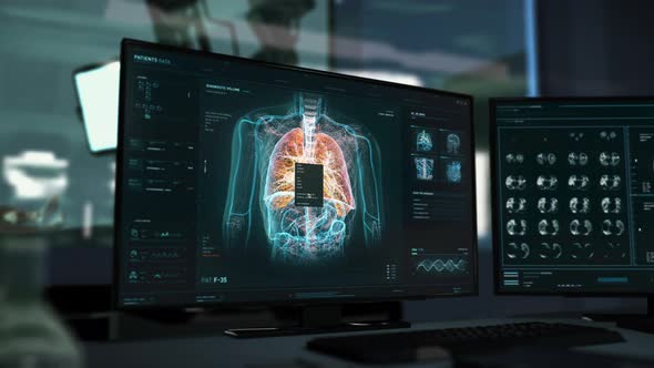 Diagnostic system studies the deep molecular structure of the lung cancer alt