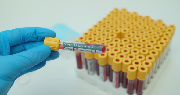 Researcher Hand Showing Tube, Positive Result of Blood Test for Coronavirus, Covid-2.