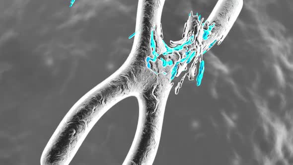 Animation of a damaged Chromosome