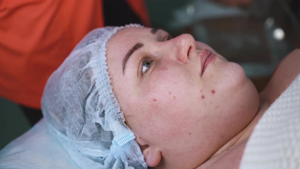 Cosmetologist in Gloves Cleans Girl Face with Wipe in Clinic