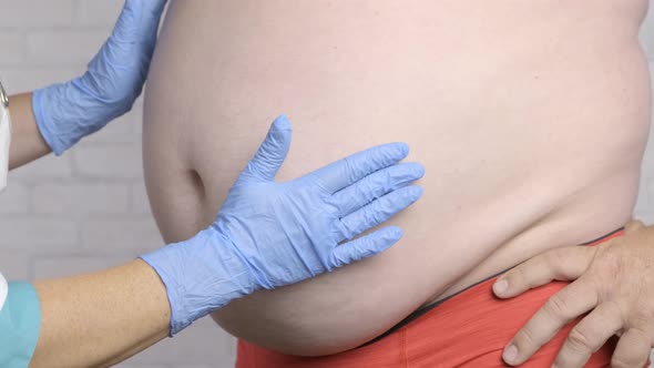 Doctor Examines a Large Belly in A Man