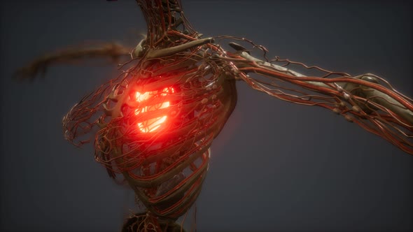 CG Animation Of A Sick Human Heart