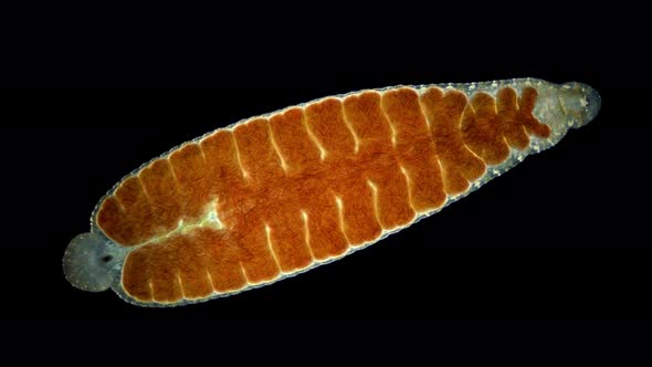 Leech of the family Glossiphoniidae under a microscope, order Rhynchobdellida