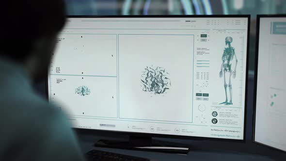 Doctor Checks Brain Of Ill Patient In High Tech Disease Diagnostic System alt