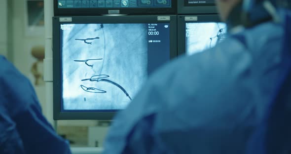 Surgeons preforming a cardiac catheterization in an operating room in a hospital