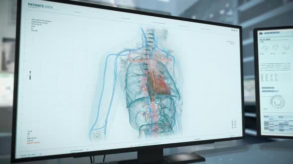 Advanced Medical Analysis Software Examines Organs In Chest Of Hospital Patient alt