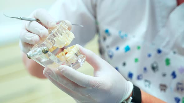 A doctor in white rubber gloves removes a denture from a jaw layout.