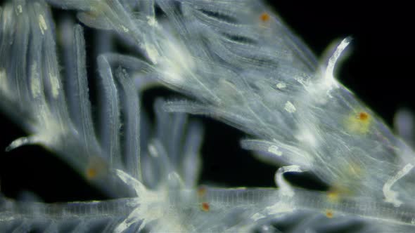 Polychaeta worm, family Sabellidae under a microscope