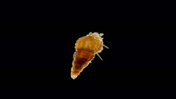 A Snail Under a Microscope, Class Gastropoda