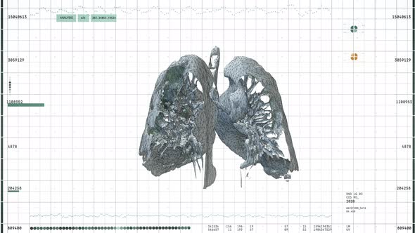 Modern computed tomography of lung injuries Covid 19. 3D scanning.User interface alt
