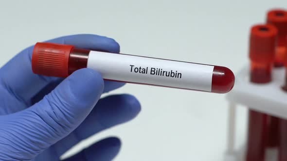 Total Bilirubin, Doctor Holding Blood Sample in Tube Close-Up, Health Check-Up