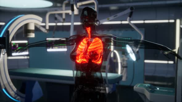 Human Lungs Radiology Exam in Laboratory alt