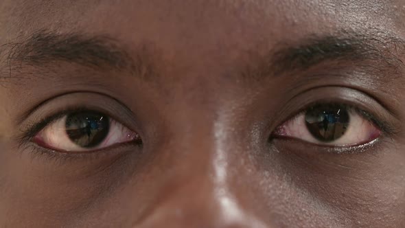Blinking Eyes of Young African Man