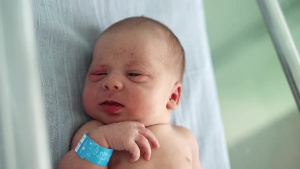 Naked Newborn Baby Red Face Portrait Acne Allergic Irritations Early Days Crying On Blue Background