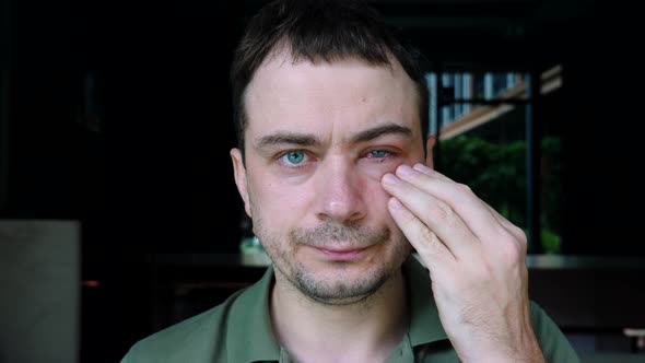 Sad Man Touch By Hand One Swollen Infected Eye with Symptom of Conjunctivitis