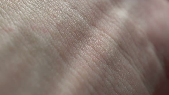 Macro Human Skin Background 