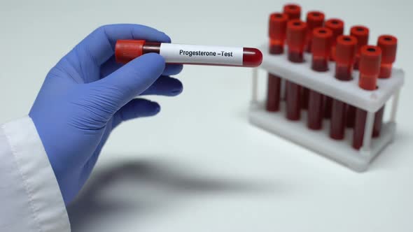 Progesterone, Doctor Showing Blood Sample in Tube, Lab Research, Health Checkup