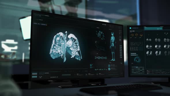 Futuristic X-ray Scanner Interface Detects Lung Cancer At A Medical Laboratory alt