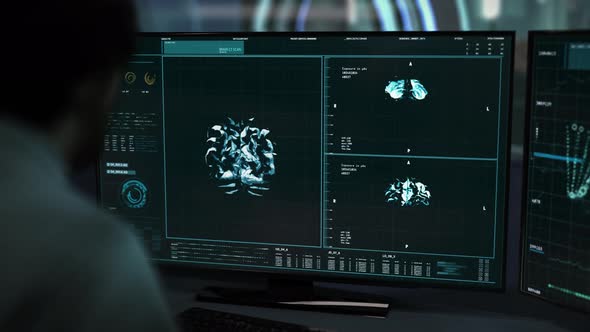 Computer Screen Shows Analysis Results During Doctor Oncology Research alt