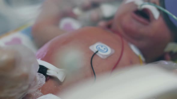 One Newborn Baby in Infant Incubator with Tubes.