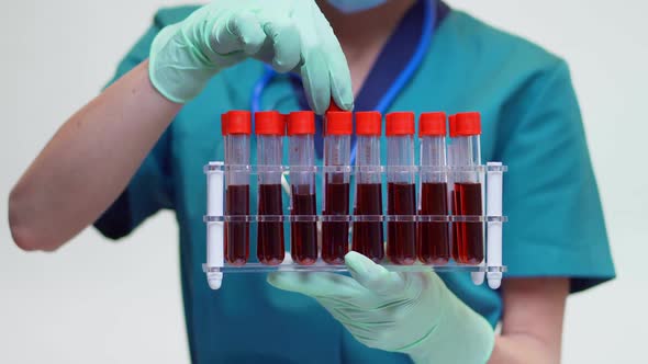 Medical Doctor Nurse Woman Wearing Protective Mask and Latex Gloves - Holding Blood Test Tube Rack