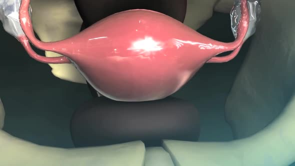 3D Animation Female Reproductive Anatomy,Uterus