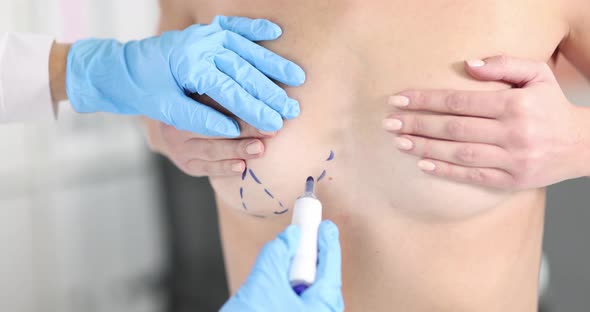 Nude Body of Sexy Woman with Blue Surgical Markings on Chest