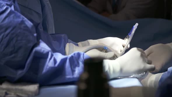 Surgeons working during surgery, close up on hands and instruments.