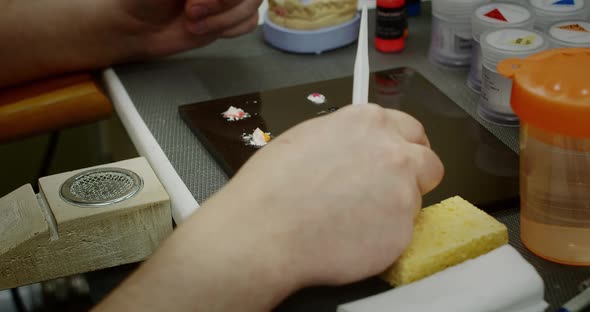 Male Hands Install a Dental Crown on the Jaw Model