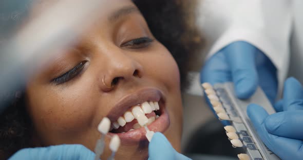 Close Up of Dentist and Assistant Choosing Color of Veneers for African Female Patient