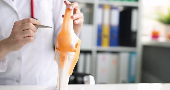 Doctor Shows Model of Human Artificial Knee Joint in Medical Office