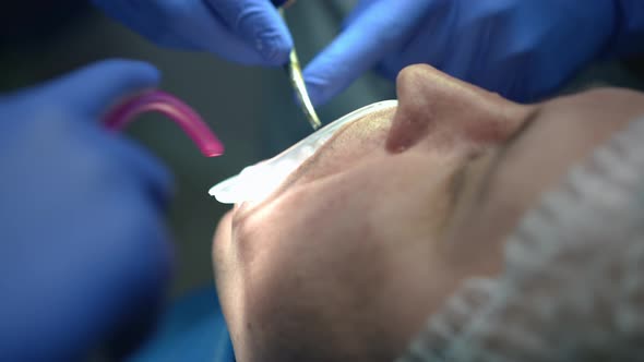 Closeup Caucasian Man in Dental Chair with Doctor and Assistant Using Dental Scissors and Sucking