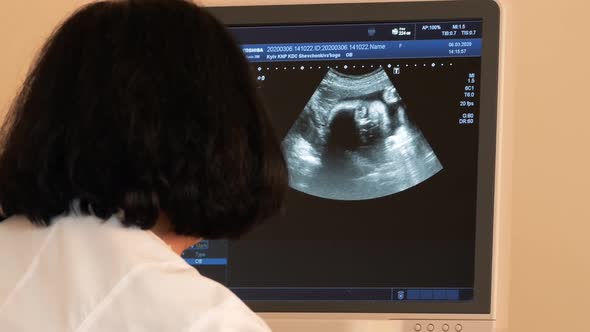 Doctor Does Utrasound Sonogram Procedure To a Pregnant Woman. Ultrasound at 7 Months of Pregnancy