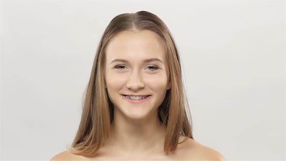 Young Girl Showing Braces on Teeth. White. Slow Motion
