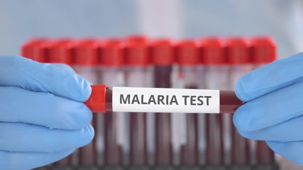 Hands in Protective Gloves Hold Tube with Malaria Test